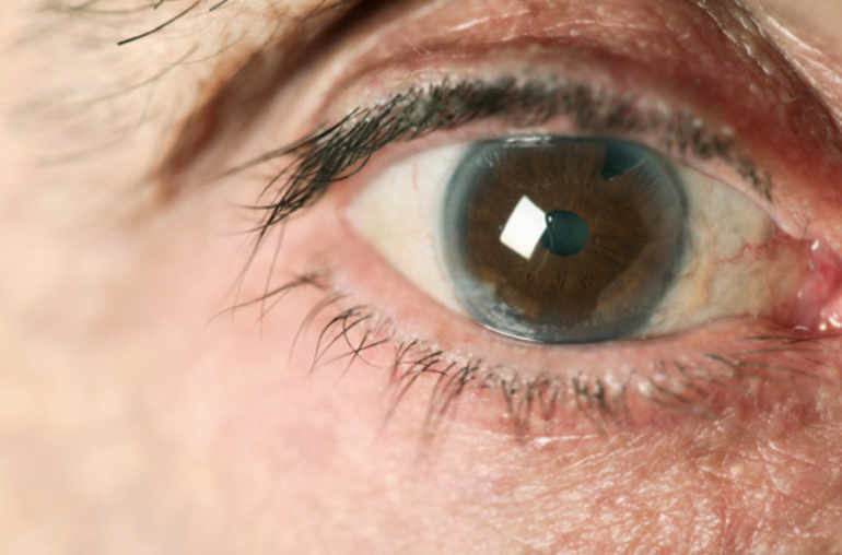 Vision floue soudaine à Errachidia examinée par le Dr Yassine Mohamed
